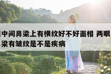 两眼中间鼻梁上有横纹好不好面相 两眼中间的鼻梁有皱纹是不是疾病