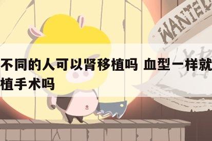 血型不同的人可以肾移植吗 血型一样就可以肾移植手术吗
