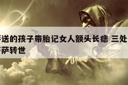 菩萨送的孩子带胎记女人额头长痣 三处有胎记菩萨转世