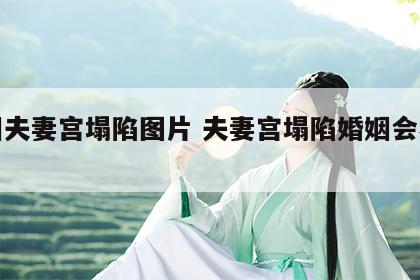 面相夫妻宫塌陷图片 夫妻宫塌陷婚姻会不好吗