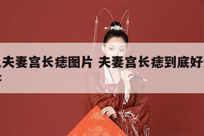女人夫妻宫长痣图片 夫妻宫长痣到底好还是不好