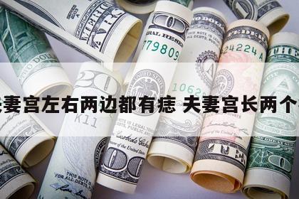 夫妻宫左右两边都有痣 夫妻宫长两个痣