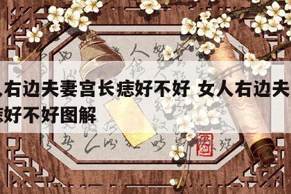女人右边夫妻宫长痣好不好 女人右边夫妻宫长痣好不好图解